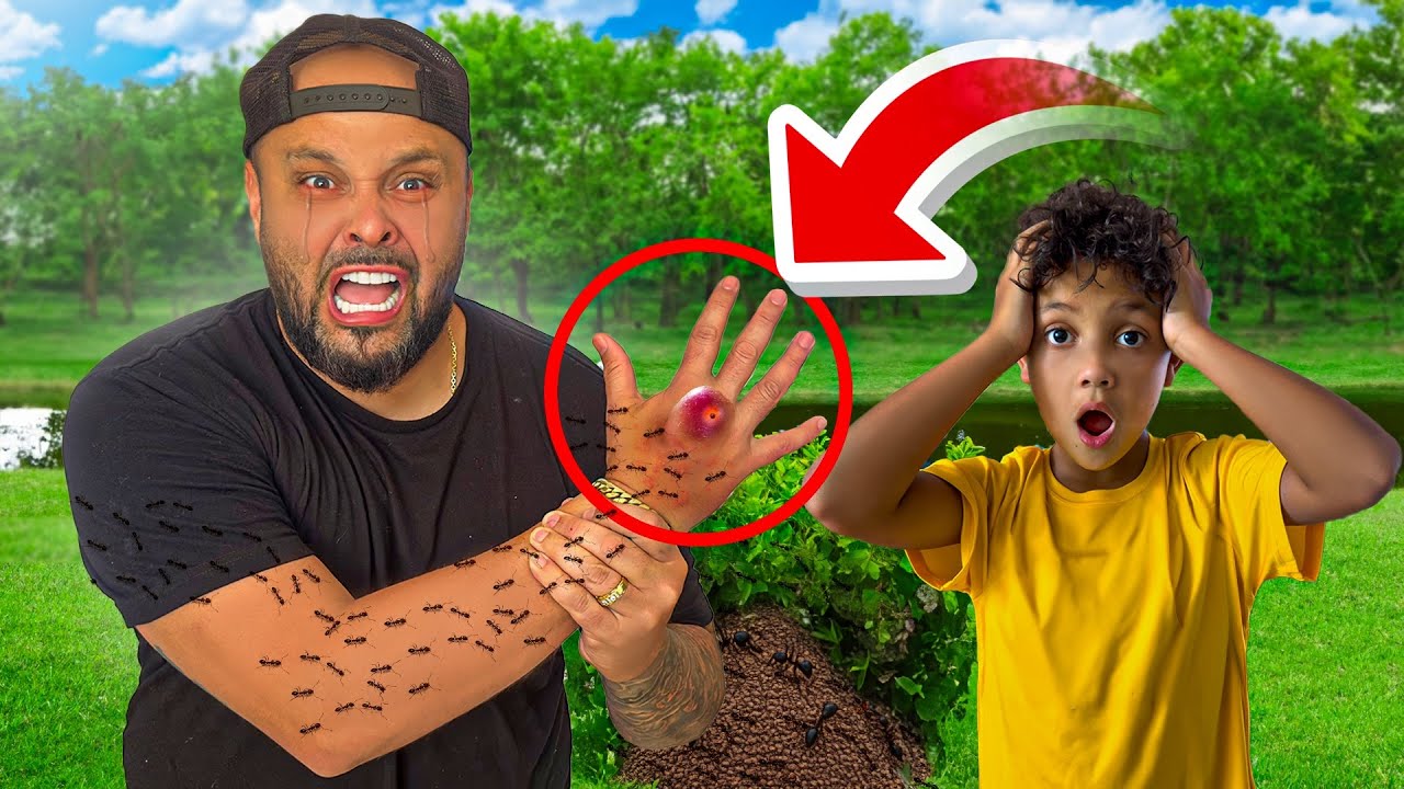 Something Happened To His HAND