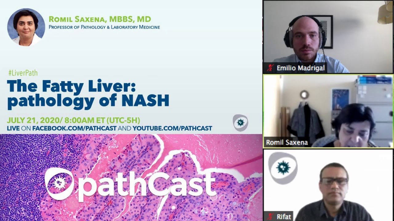 The Fatty Liver: pathology of NASH with an emphasis on fibrosis - Dr. Saxena (IU) #LIVERPATH