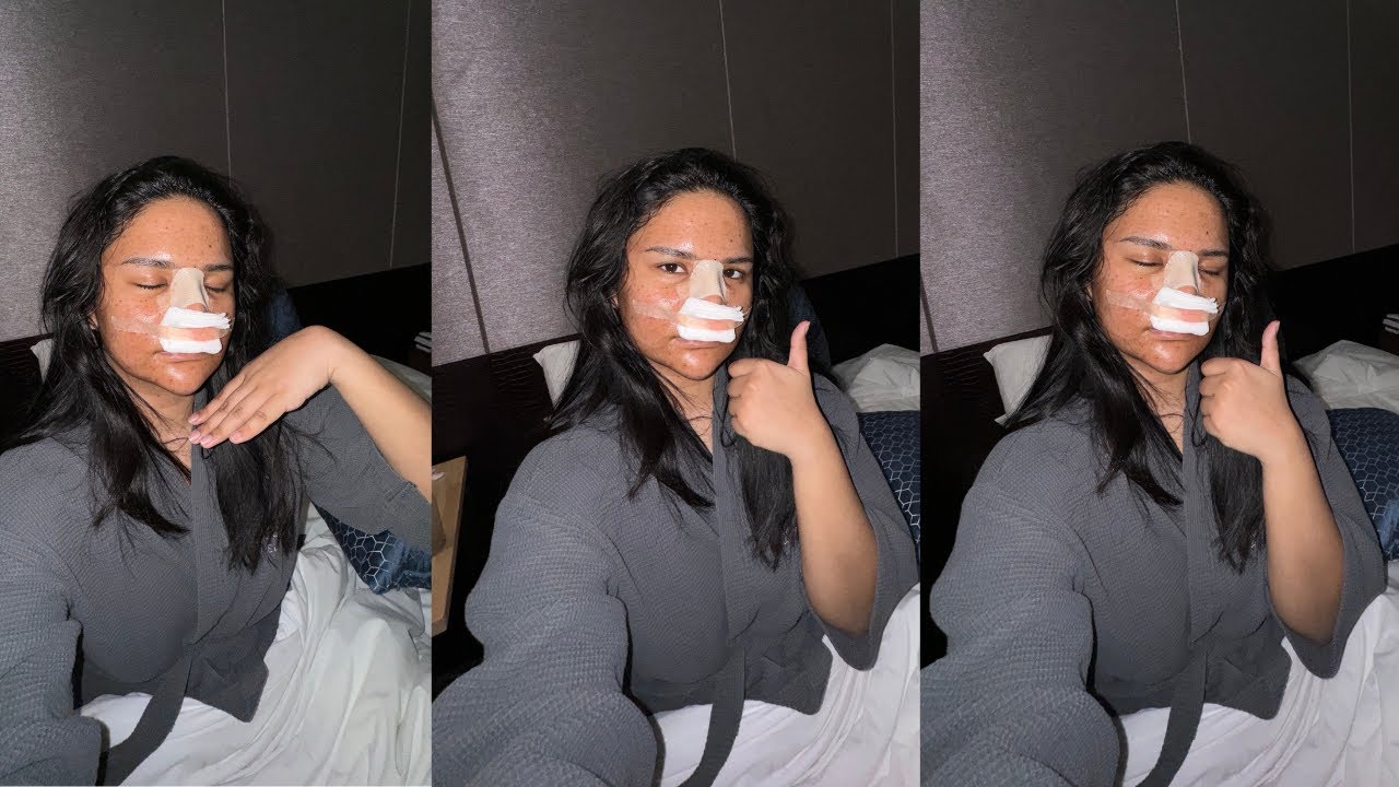 Rhinoplasty Vlog in KOREA !!