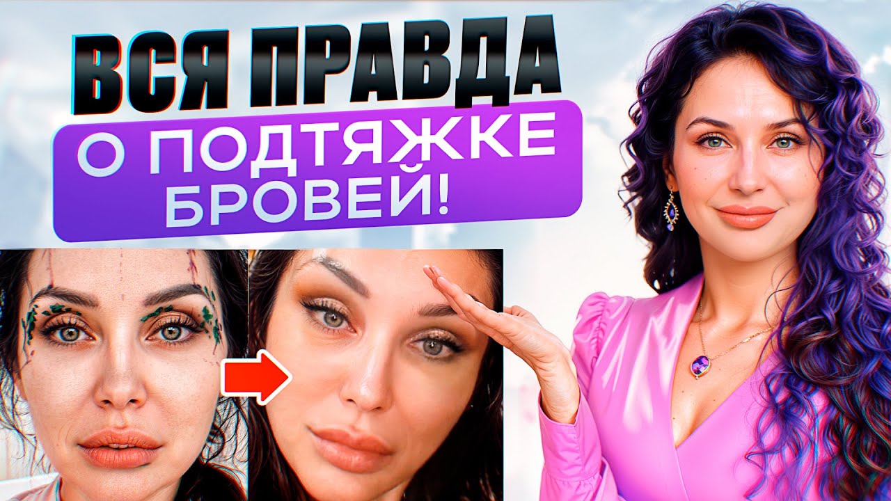 Вся правда про эндоскопический лифтинг! Подтяжка бровей