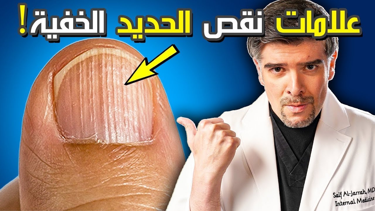 ⁧7 علامات غريبة عندك نقص الحديد و افضل علاج طبيعي (بشهرين!)⁩