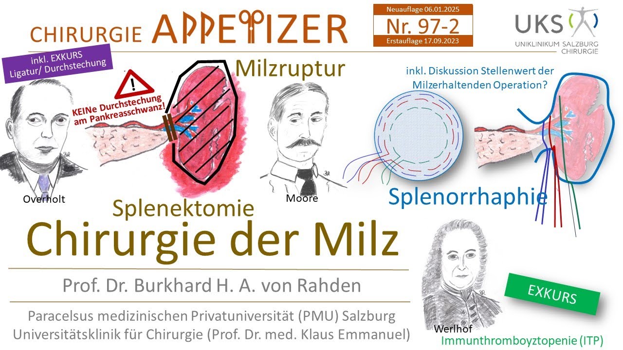 Chirurgie der Milz Splenektomie Splenorrhaphie Immunthrombozytopenie CHIRURGIE APPetizer Nr. 97-2