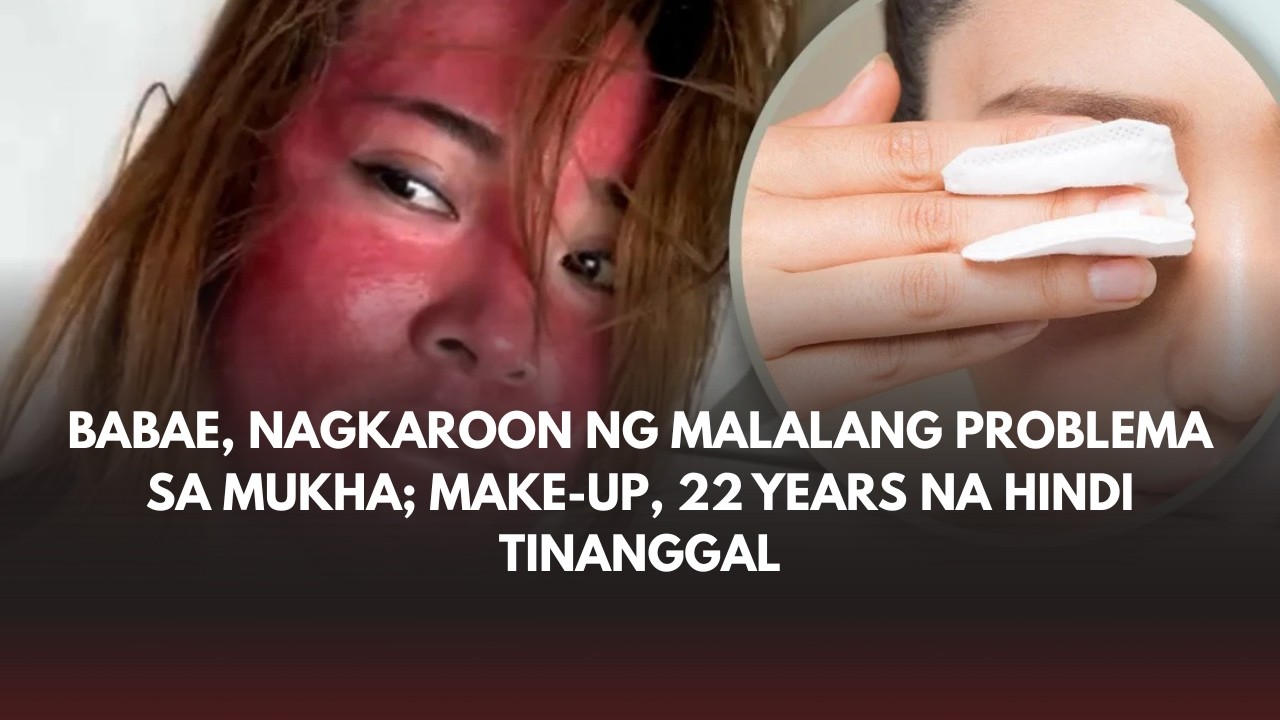 Babae, nagkaroon ng malalang problema sa mukha; make-up, 22 years na hindi tinanggal
