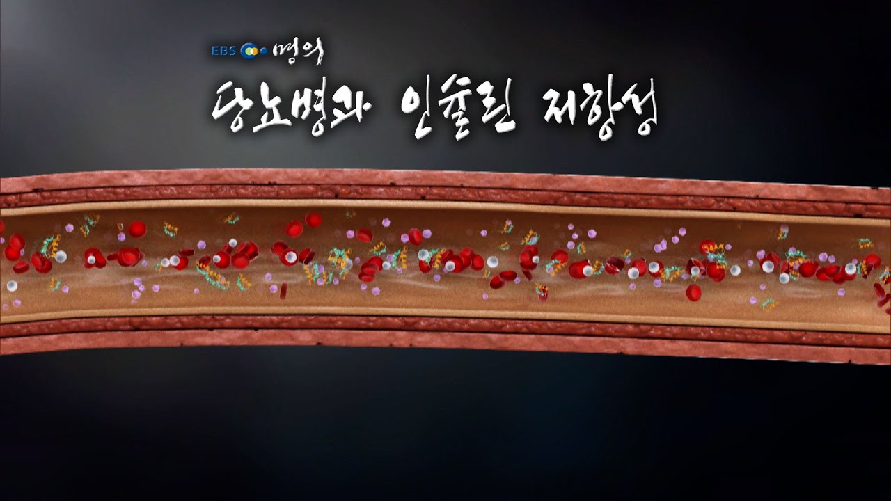 [명의 의학백과📖] 당뇨병과 인슐린 저항성