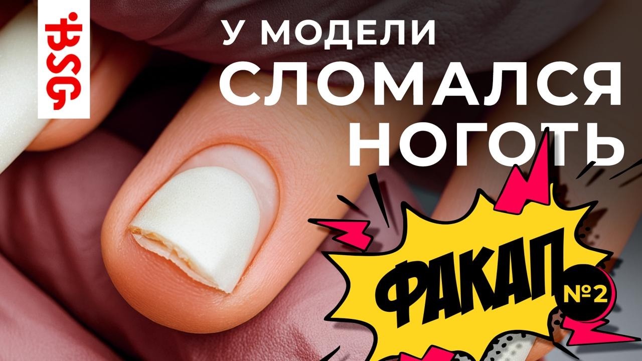 🔥 СЛОМАЛСЯ НОГОТЬ У ТЕХНОЛОГА?! Разбор «факапа» без оправданий