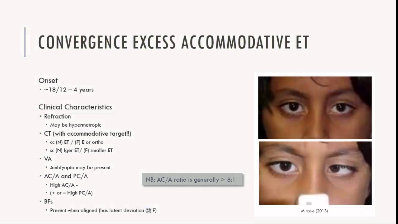 Convergence Excess ET Characteristics