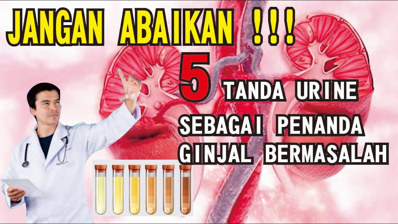 JANGAN ANGGAP SEPELE! Urine Seperti Ini = Ginjal Anda Berteriak Minta Tolong!