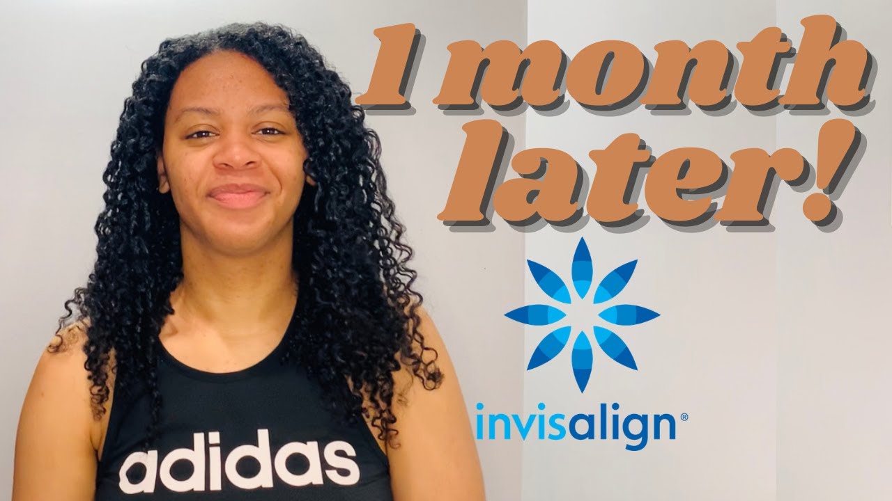 Finished Invisalign - 1 Month Later