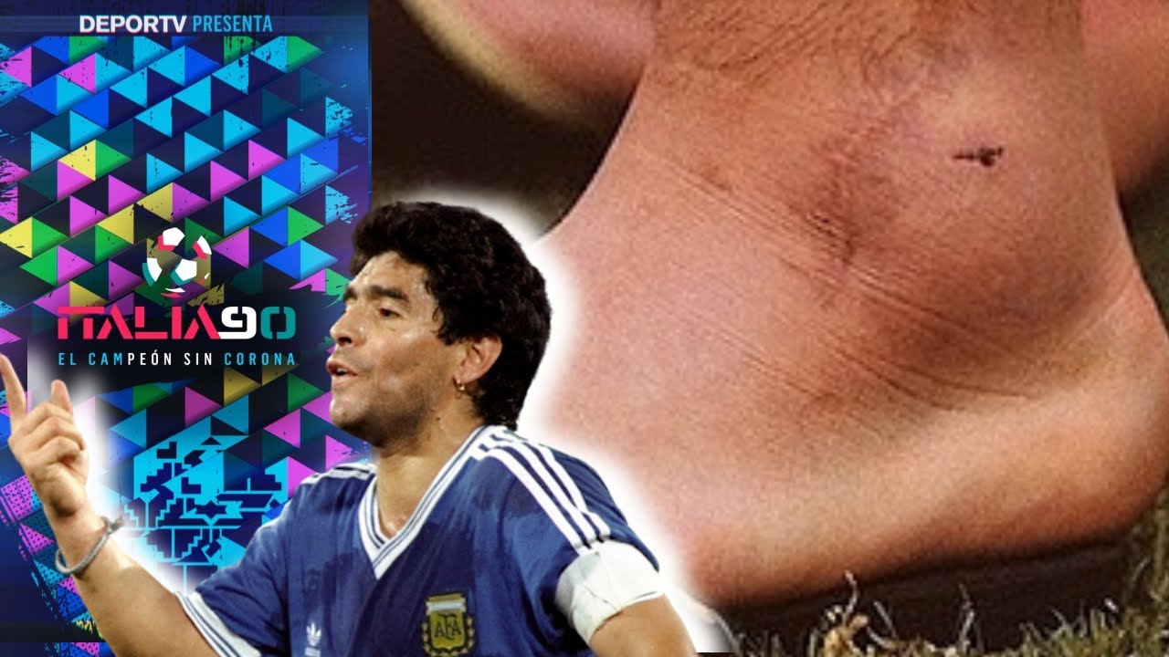 DOLOROSO - La verdadera historia del tobillo de Diego Maradona en el Mundial de Italia '90