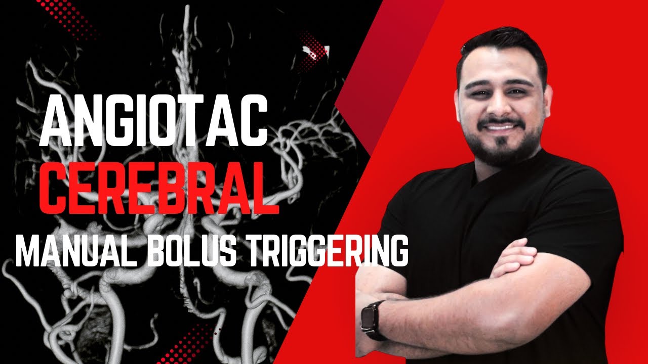 Tutorial Angiotomograf&iacute;a Cerebral | Toshiba 16 cortes | T&eacute;cnica Manual Bolus Triggering