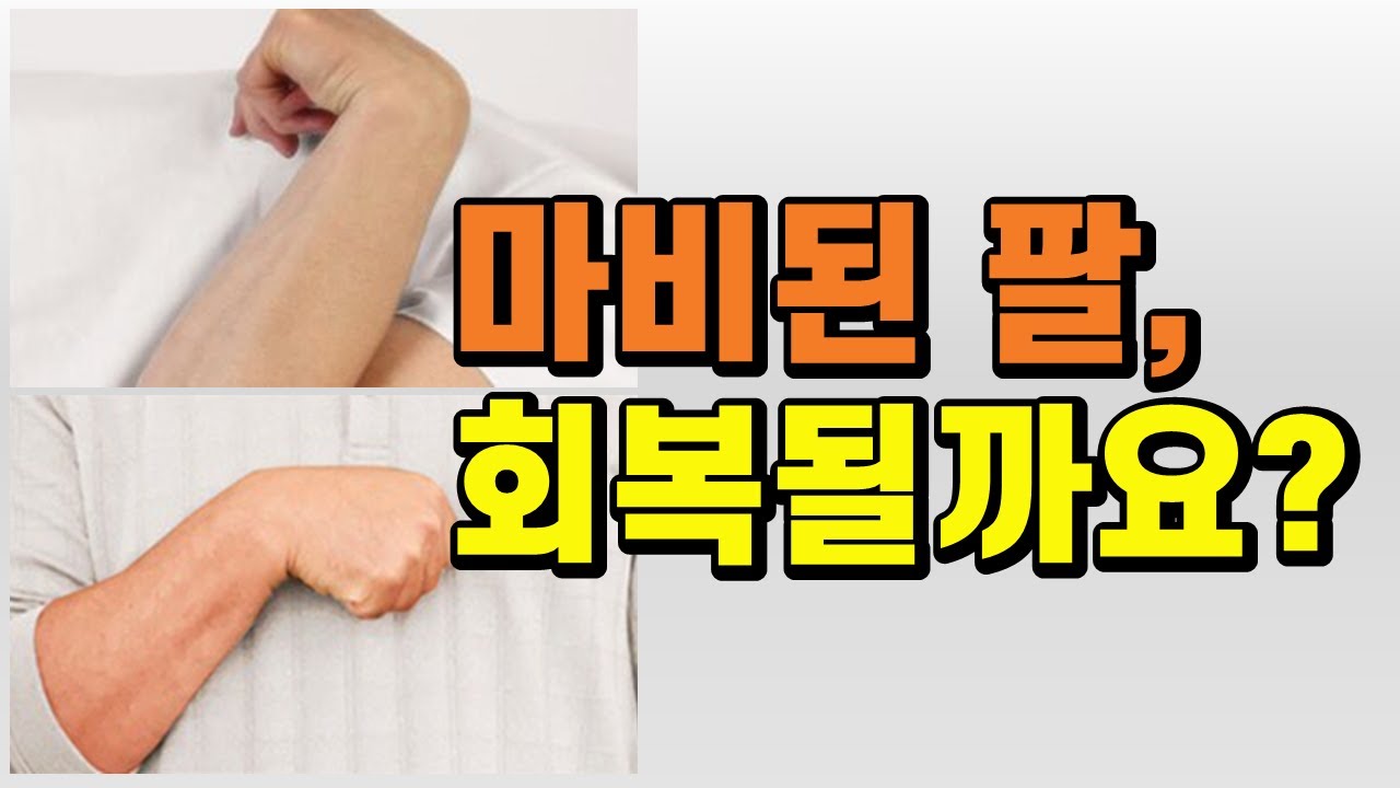 뇌출혈/뇌경색 후 마비 회복 과정