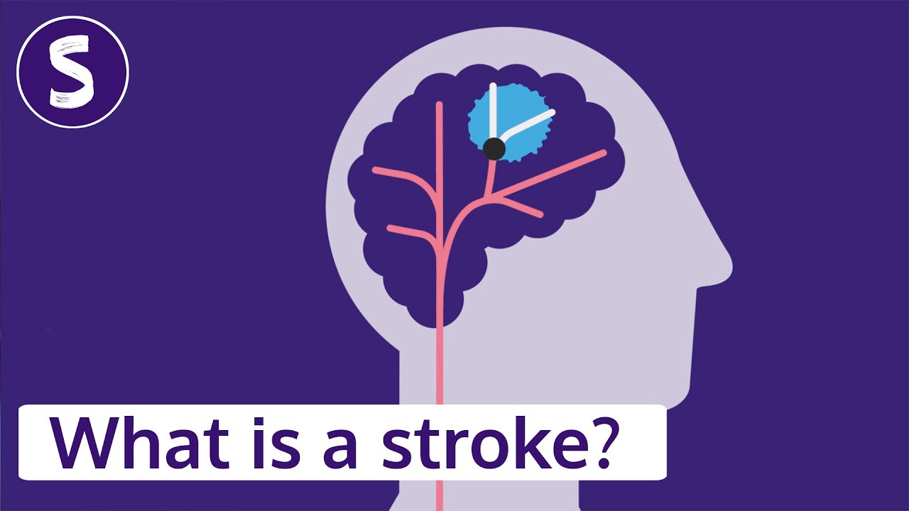 What is a stroke? Explaining the symptoms, effects and life after stroke
