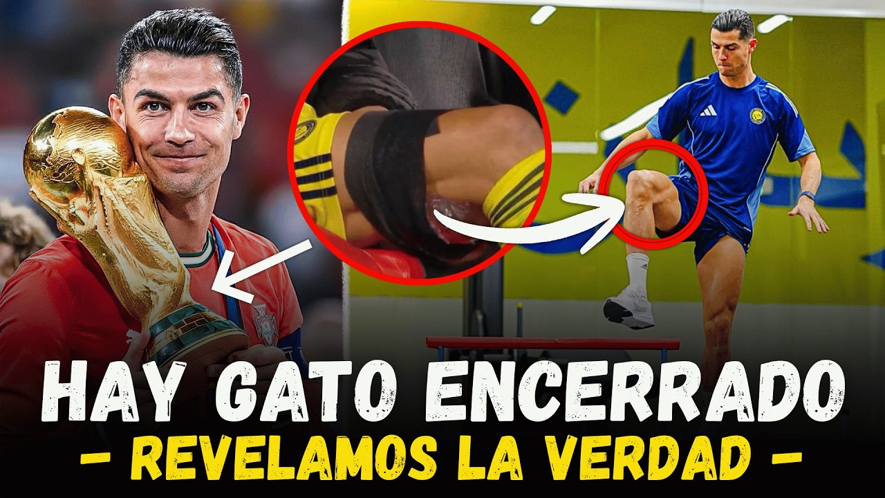 👀🔥 La VERDAD OCULTA detr&aacute;s de la (supuesta) LESI&Oacute;N de CRISTIANO RONALDO con Al-Nassr