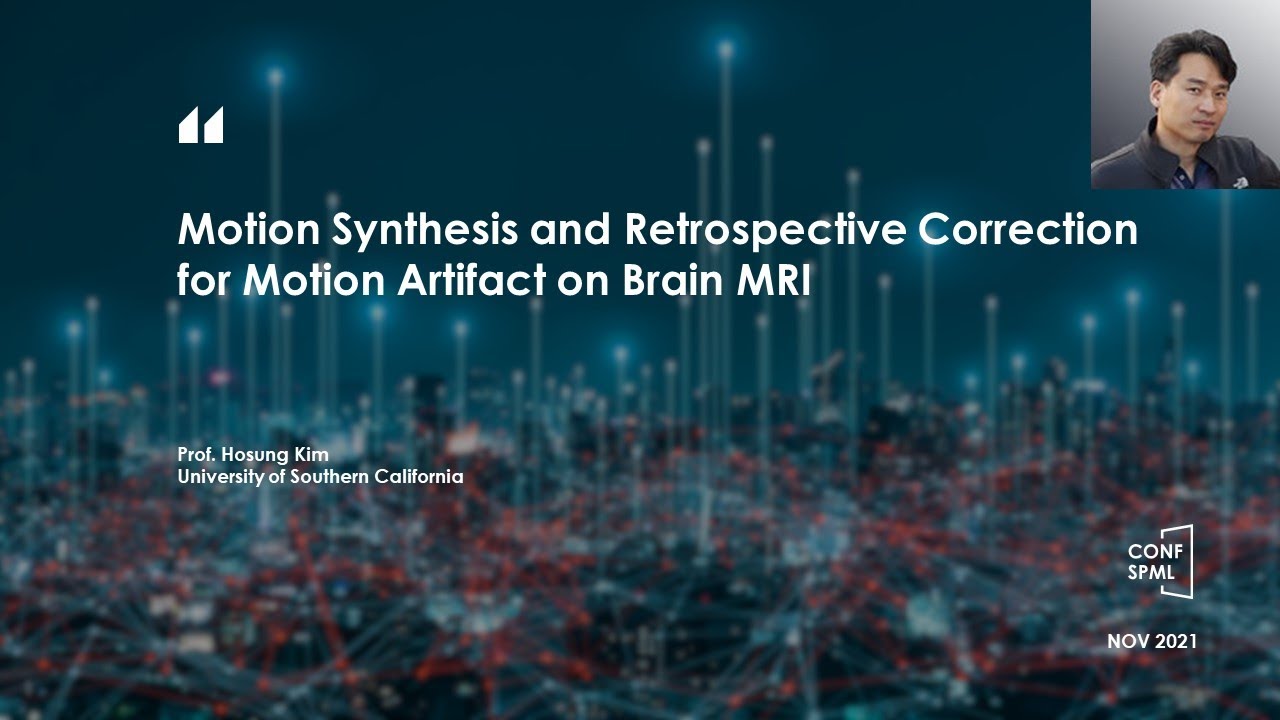 CONF-SPML 2021 &ndash; Motion Synthesis and Retrospective Correction for Motion Artifact on Brain MRI