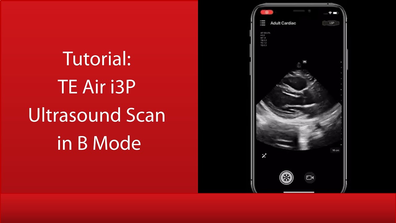 Mindray TE Air Tutorial - Scan in B Mode