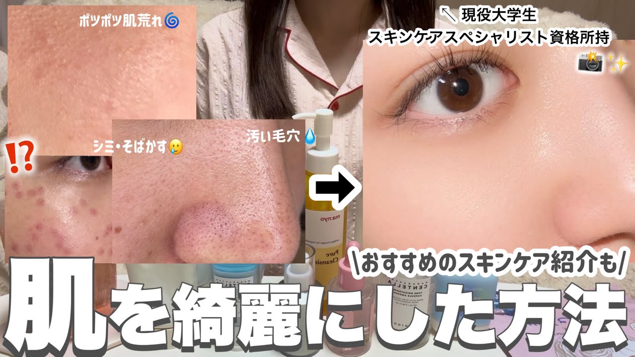 【垢抜けたい人必見‼️】美容オタクが肌を綺麗にするためにしたこと📝スキンケアスペシャリストが解説🔍🗣️ #スキンケア＃毛穴ケア＃ニキビケア＃美容#垢抜け
