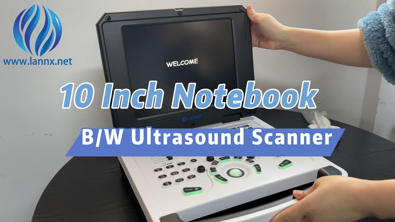 uRason N8 10 Inch Notebook Type Digital B/W Ultrasound Scanner with Convex Probe Overview