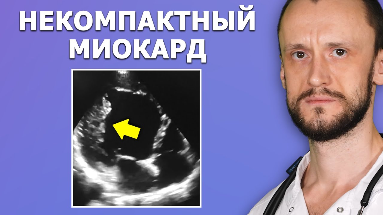 Некомпактный миокард