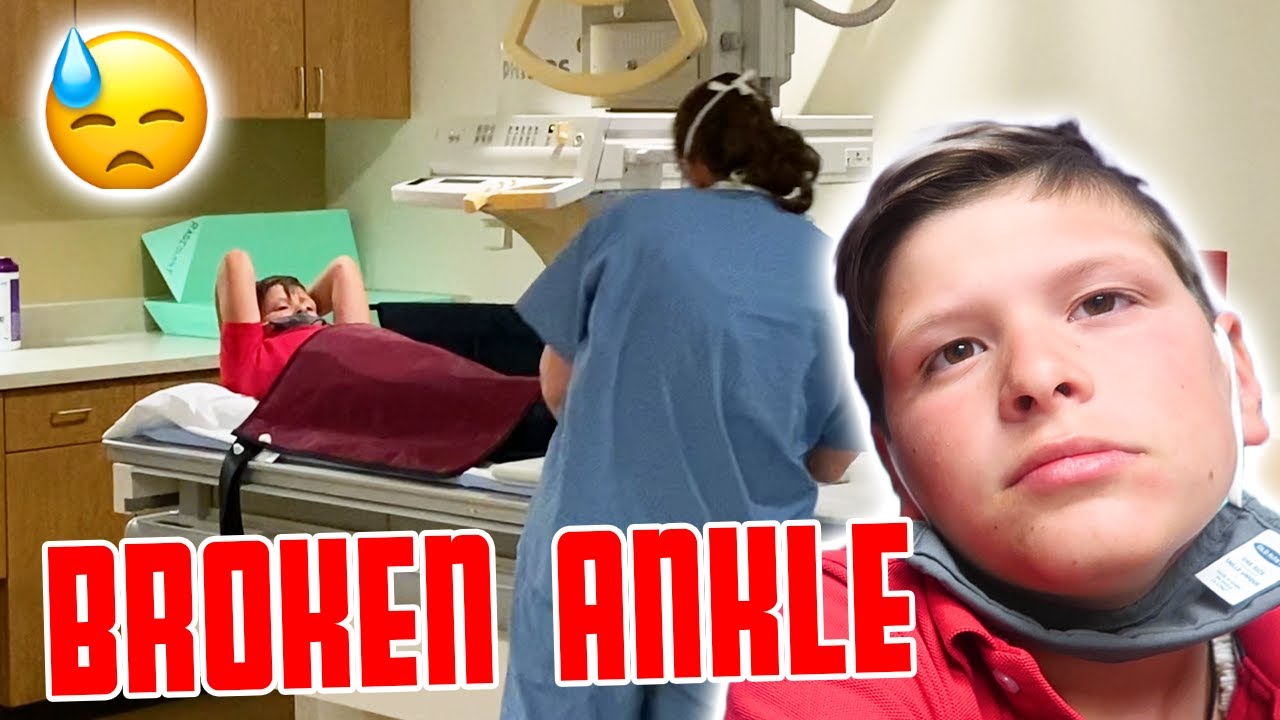 X-RAY RESULTS ARE IN | UPDATE ON ANKLE | IS IT BROKEN?