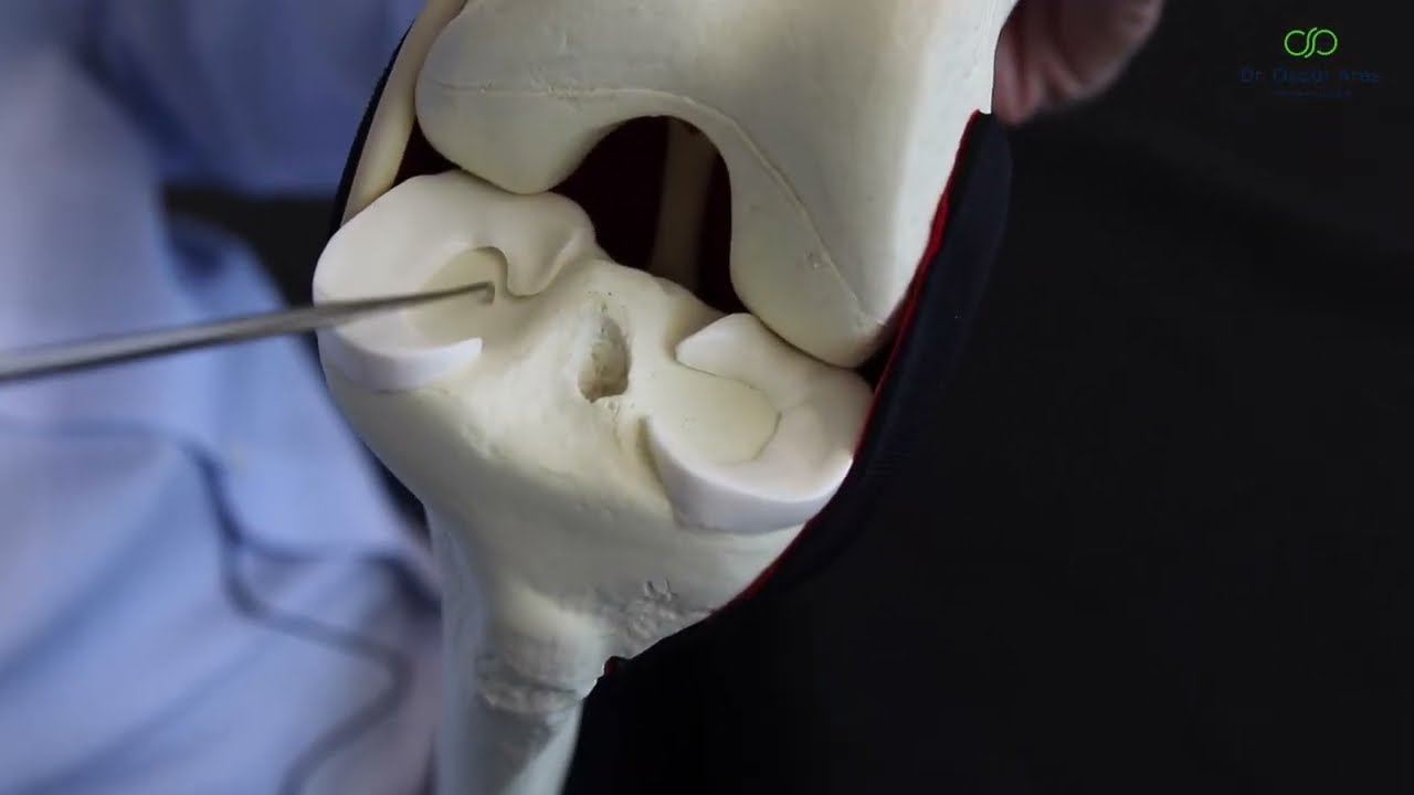 Anatomía de la rodilla (Parte 2) - Dr. Oscar Ares