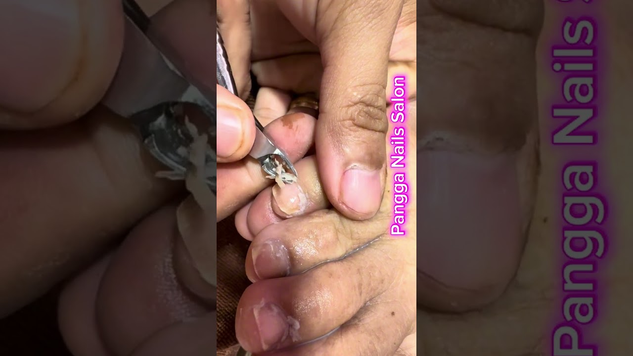 Nails cleaning 