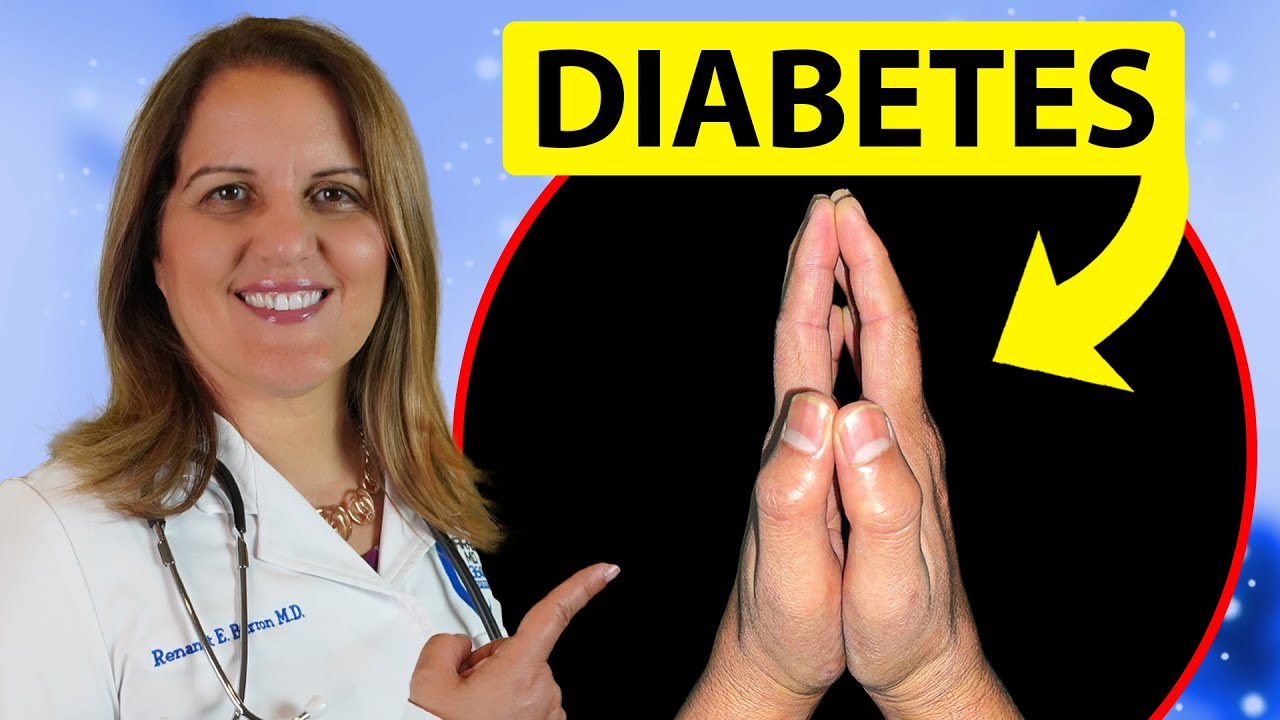 10 Signs You Might Have DIABETES and Not Know It - Doctor Explains