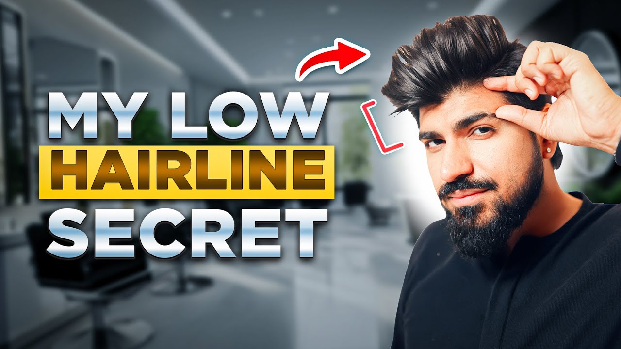 6 Ways to Fix Receding Hairline | My Low Hairline Secret | Sahil Gera