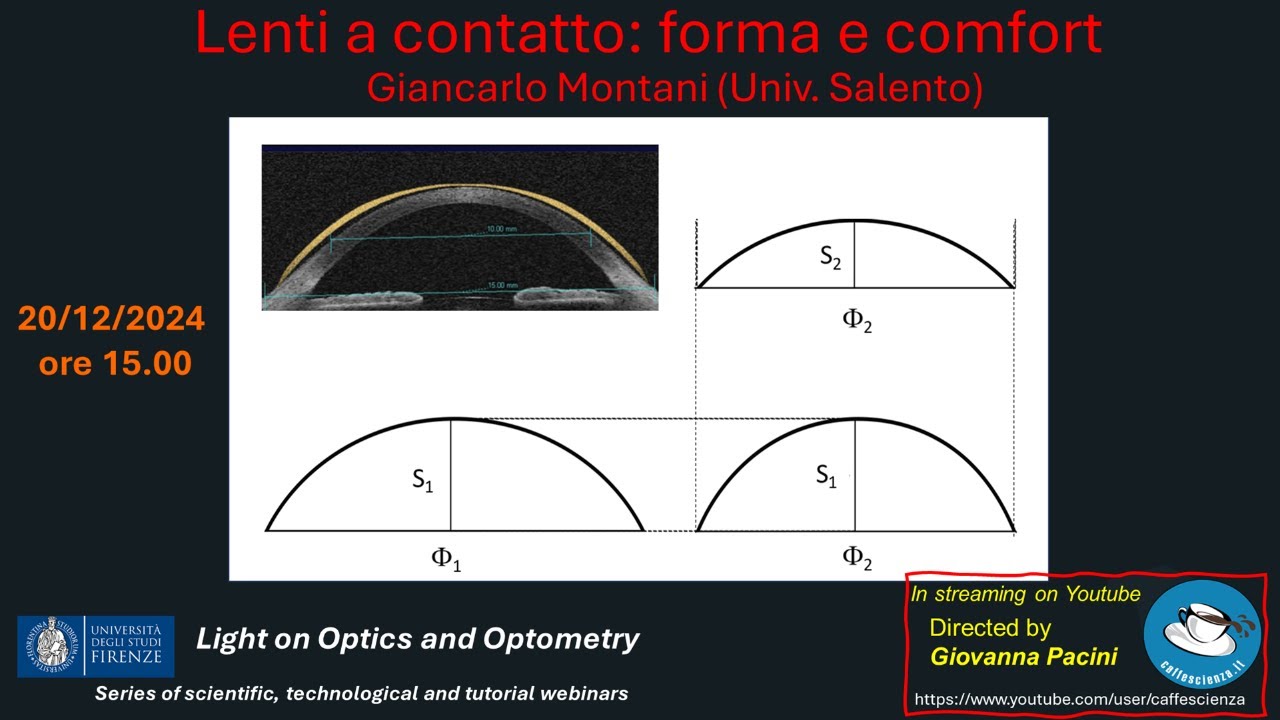 Lenti a contatto: forma e confort