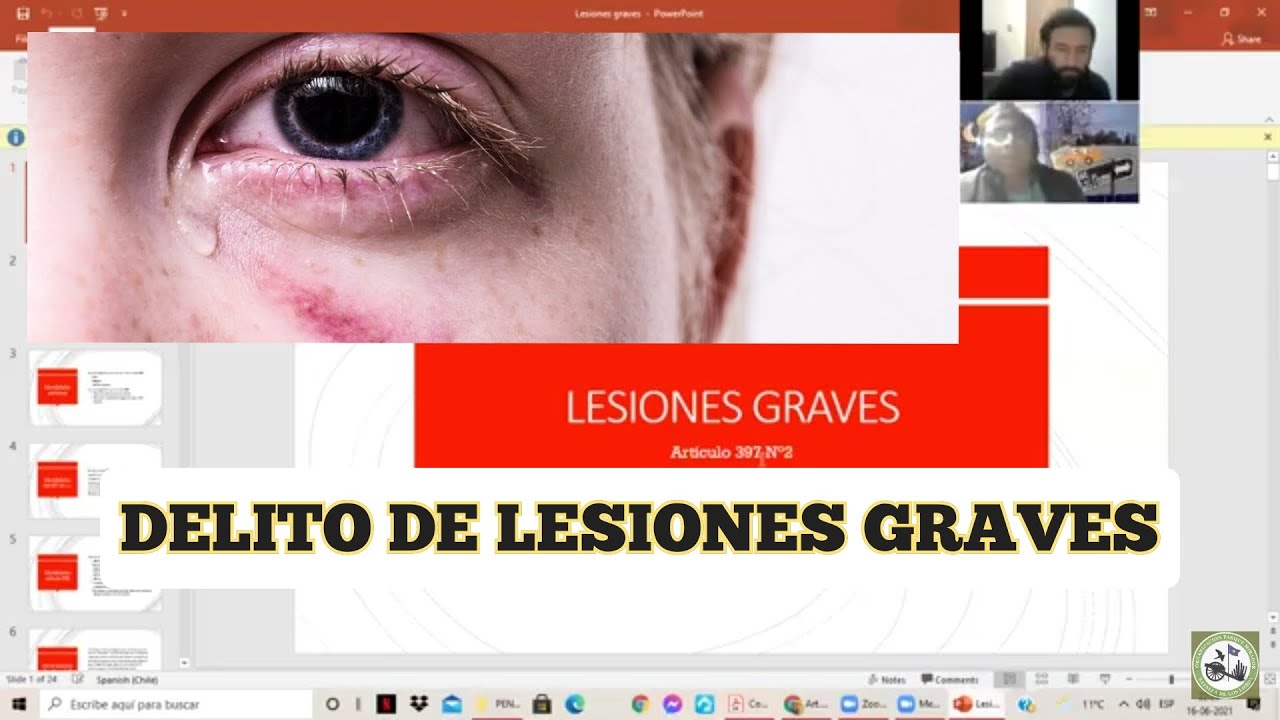 Delito de Lesiones graves, castración y mutilación, Universidad del Alba, La Serena, Chile
