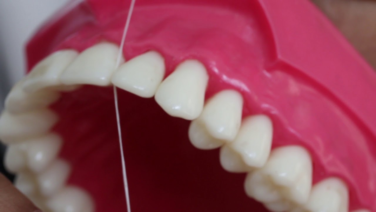 Limpieza bucal con hilo dental