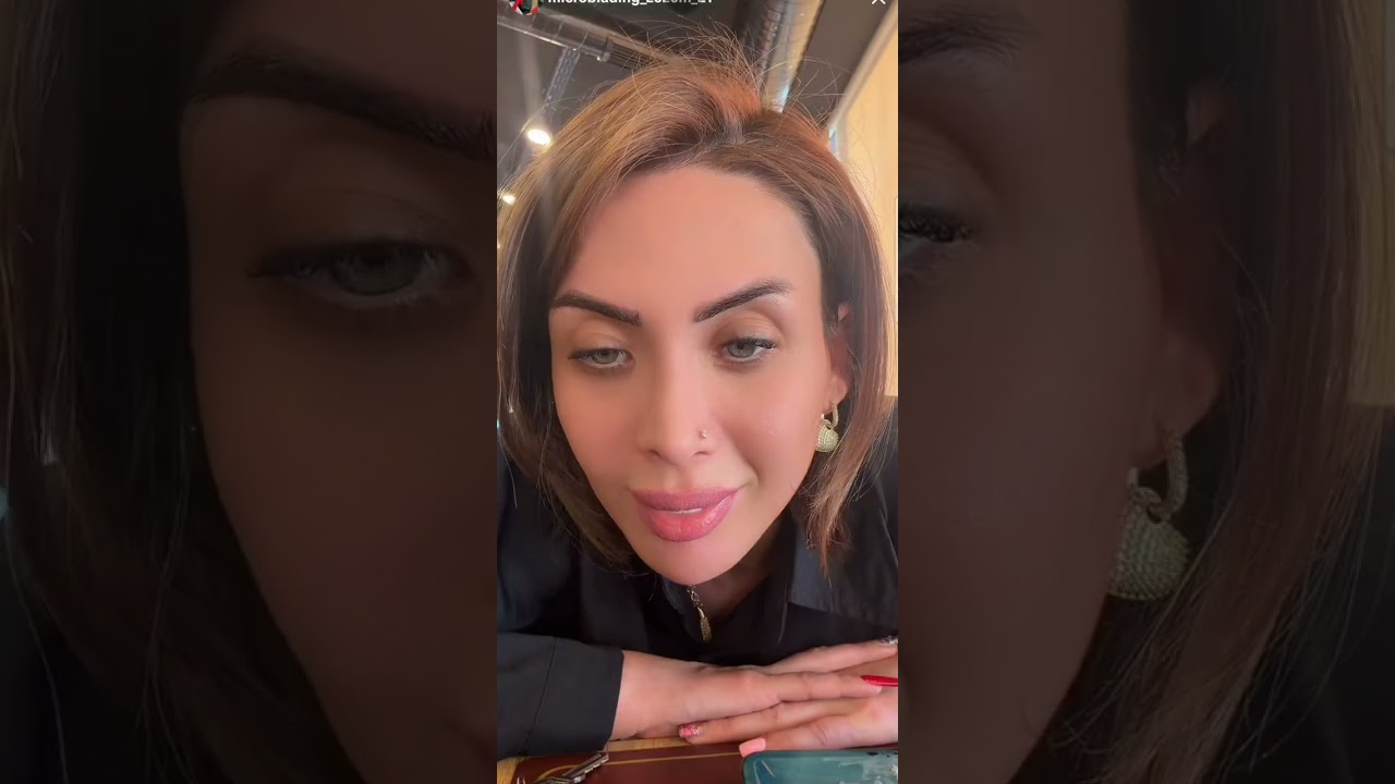 Zuzunun oğlunun səhhətində problem.Çox kökəlməsi ayaqlarında çətinlik yaratdı!😒😒🙏 