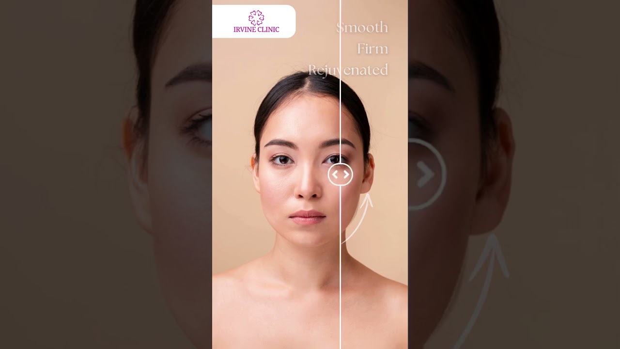 Irvine Clinic &ndash; From Dull to Radiant: Wrinkle-Free Skin Transformation