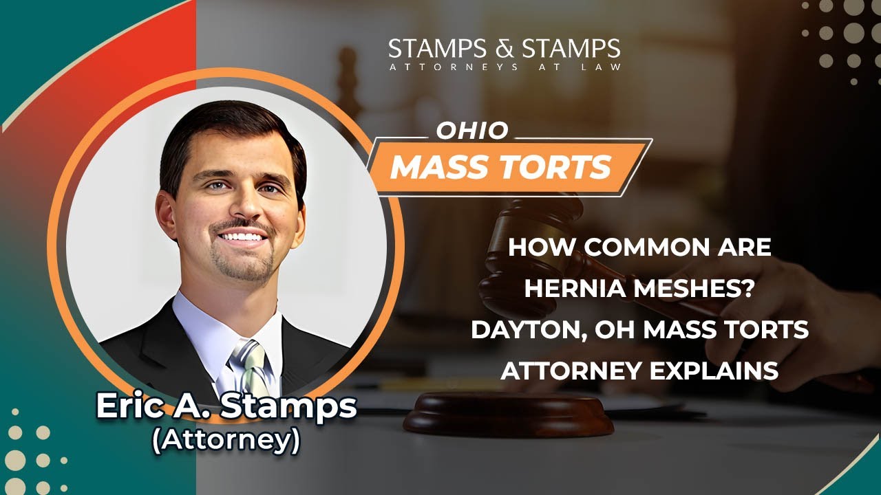 How Common Are Hernia Meshes? Dayton, OH Mass Torts Attorney Explains