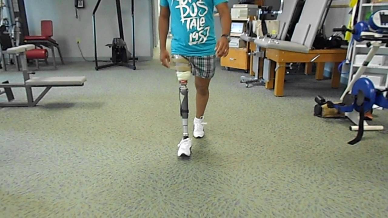 prosthetic leg man walking video