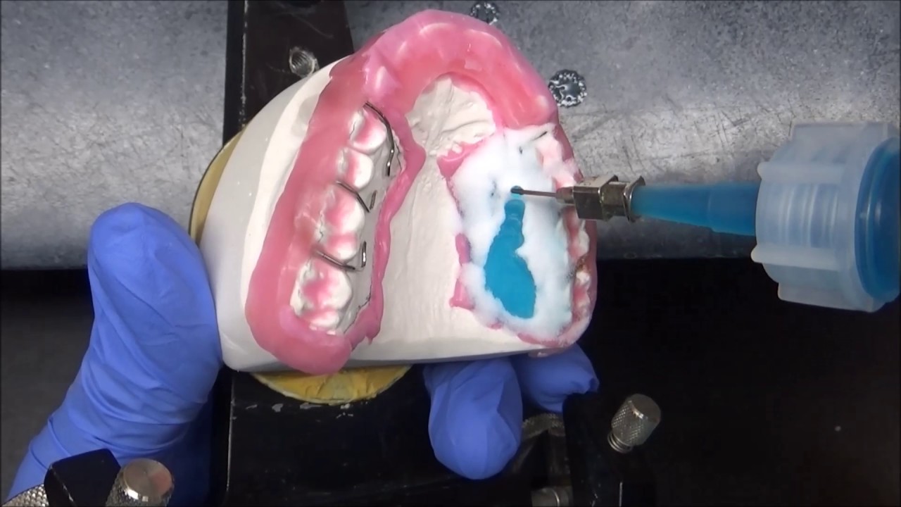 Aktivator 3/4 Tiefbiss Deepbite Activator Orthodontics
