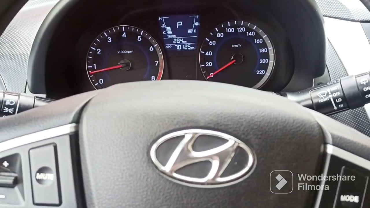 p2101-p2118 Hyundai Accent