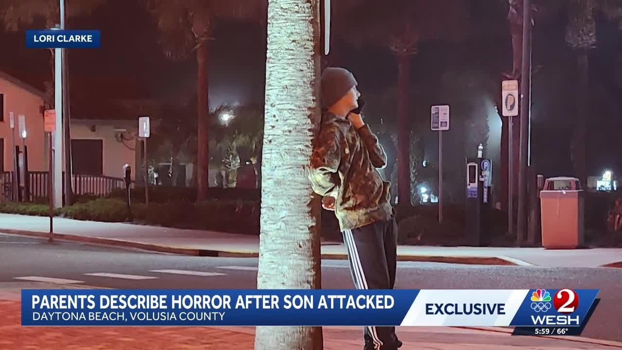 13-year-old's major artery missed by millimeter in Daytona attack
