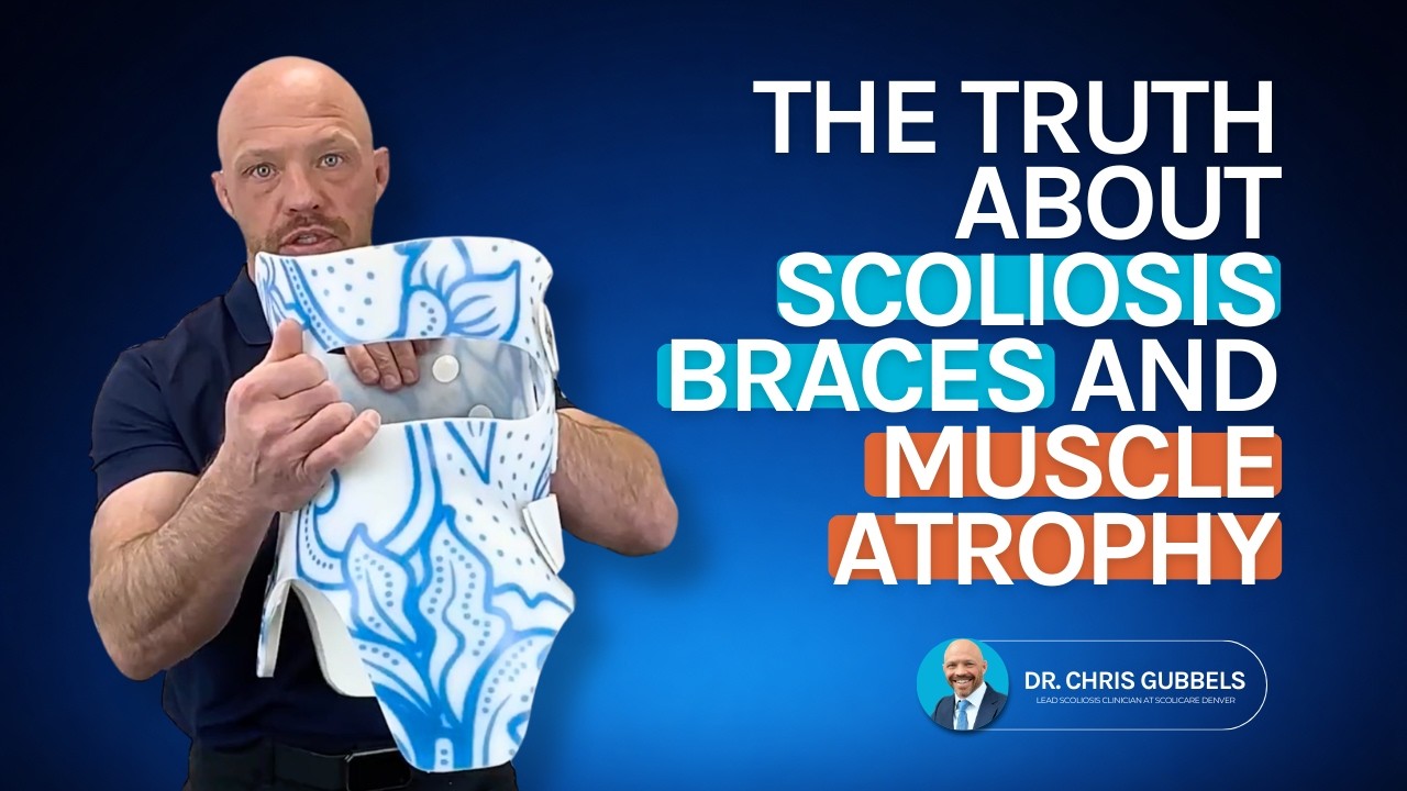 The Truth About Scoliosis Bracing and Muscle Atrophy