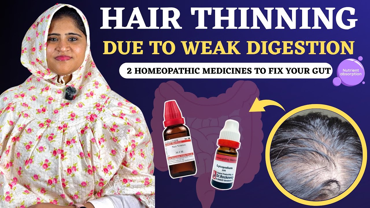 Hair Fall Due to Weak Digestion? 2 Homeopathic Medicine to Fix Vitamin Absorption | Dr. Arwa Bohra