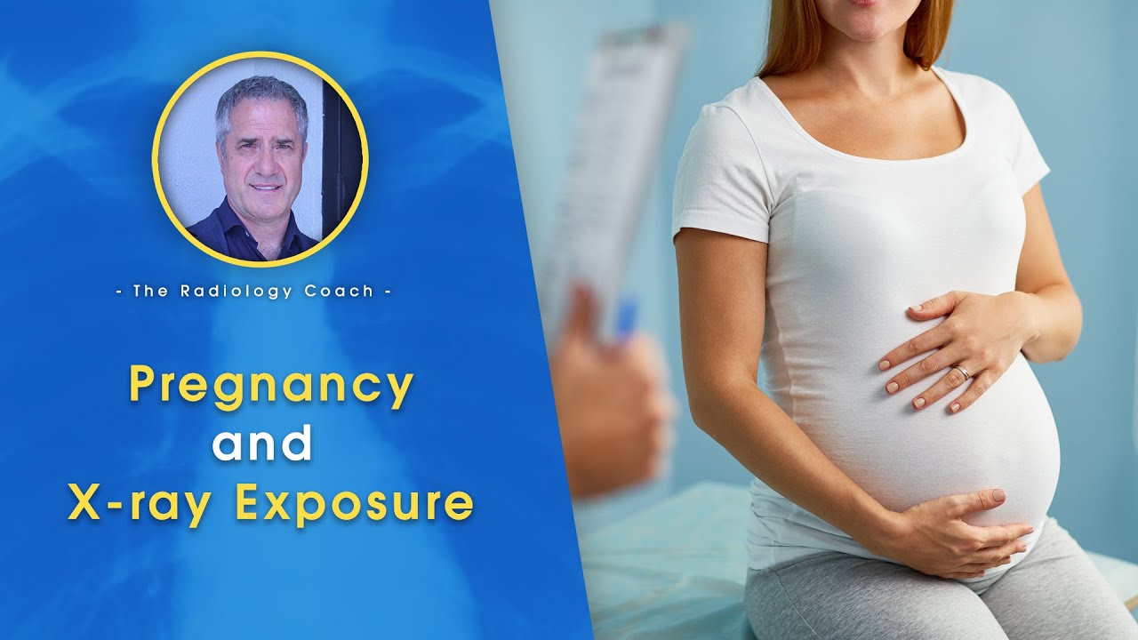PREGNANCY and X ray EXPOSURE