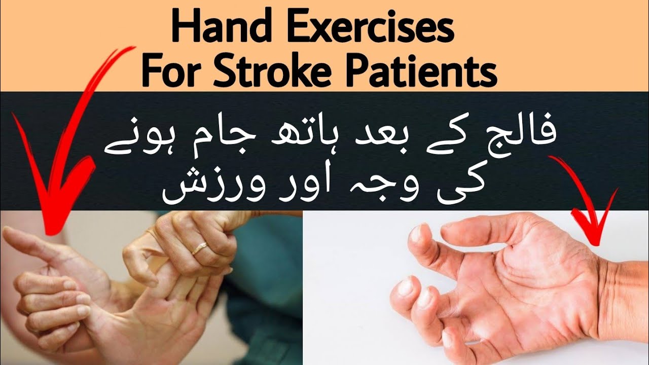 Exercise For Hand After Stroke in Hindi/Urdu | Falij K bad Hath jam ho jana - Dr Aqeel Mahboob