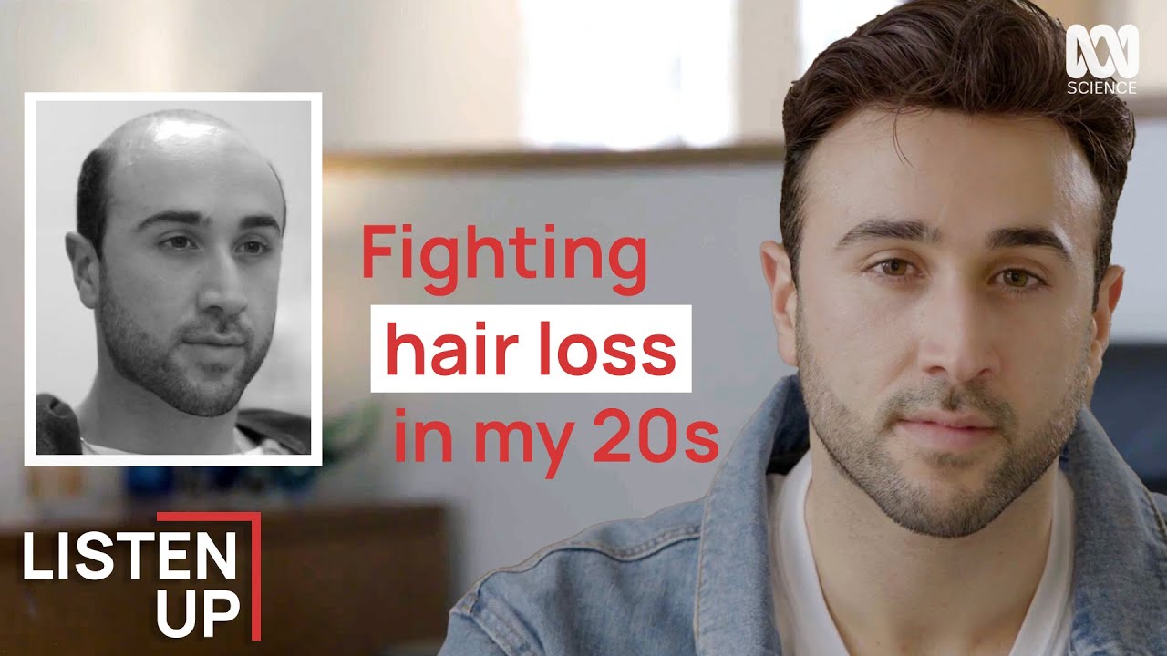 «Я начала терять волосы в 20 лет»