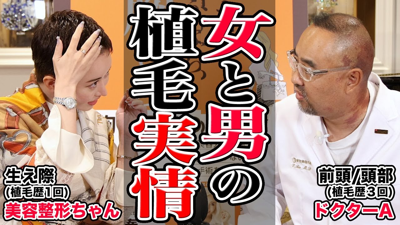 【後編】美容整形ちゃんとドクターAの女と男の植毛実体験【ドクターA（麻生泰）】