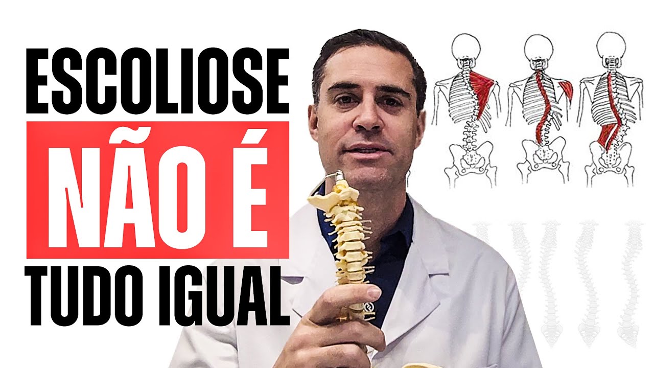 A diferen&ccedil;a entre ESCOLIOSE em adultos e adolescentes