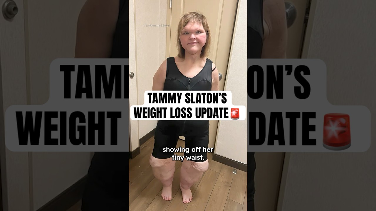 Tammy Slaton's Weight Loss Update #shorts #1000lbsisters