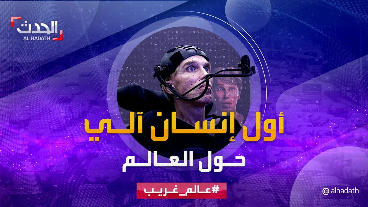 قصة أول سايبورغ كامل في العالم.. دمج في جسده أجهزة إلكترونية وروبوتية