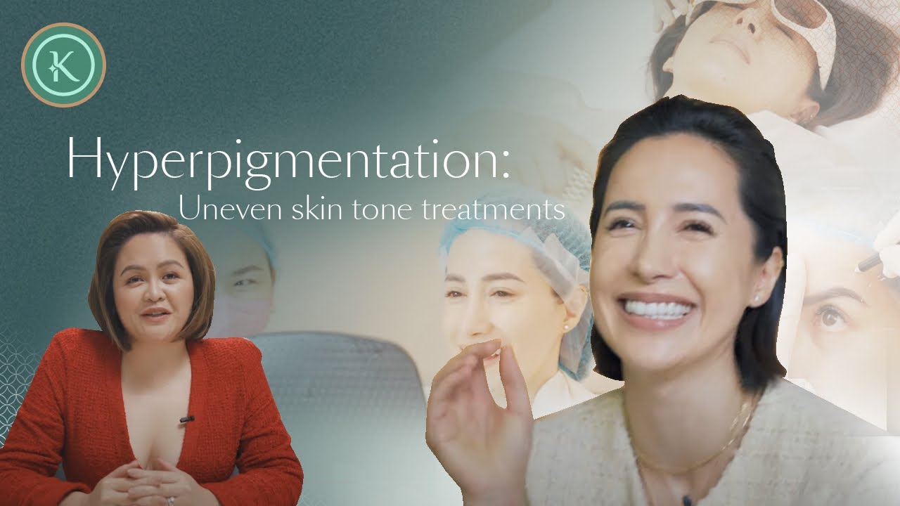 Hyperpigmentation: Uneven skin tone treatments