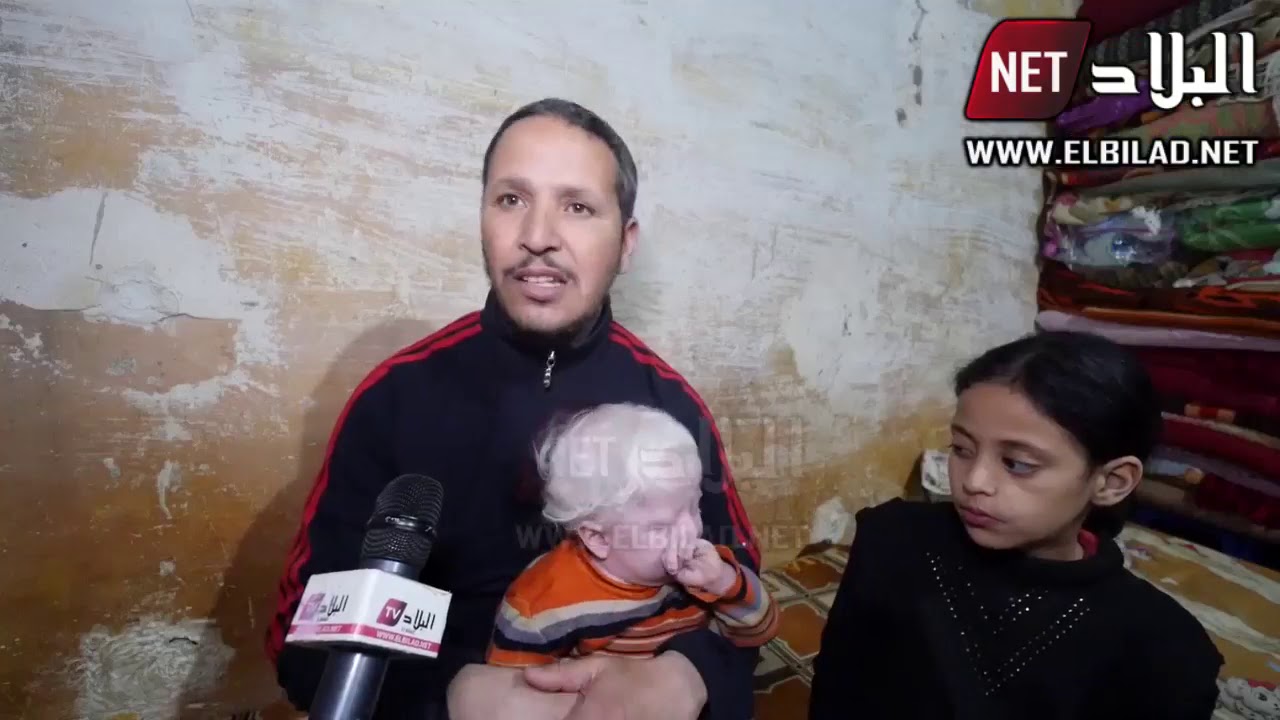 أطفال القمر يصارعون الموت يوميا في صمت وعائلة ياحي يحيى بآفلو تستغيث مع انتشار كورونا