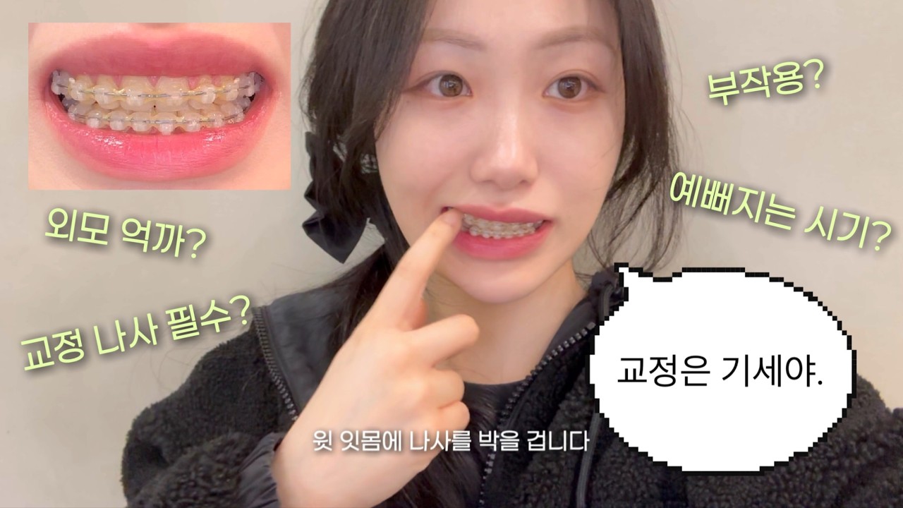 🦷돌출입 교정 전후 비교| 외모얶까 시기 이겨내는 꿀팁‼️, 비발치 5개월차 찐후기💡| 잇몸 나사+고무줄 지옥