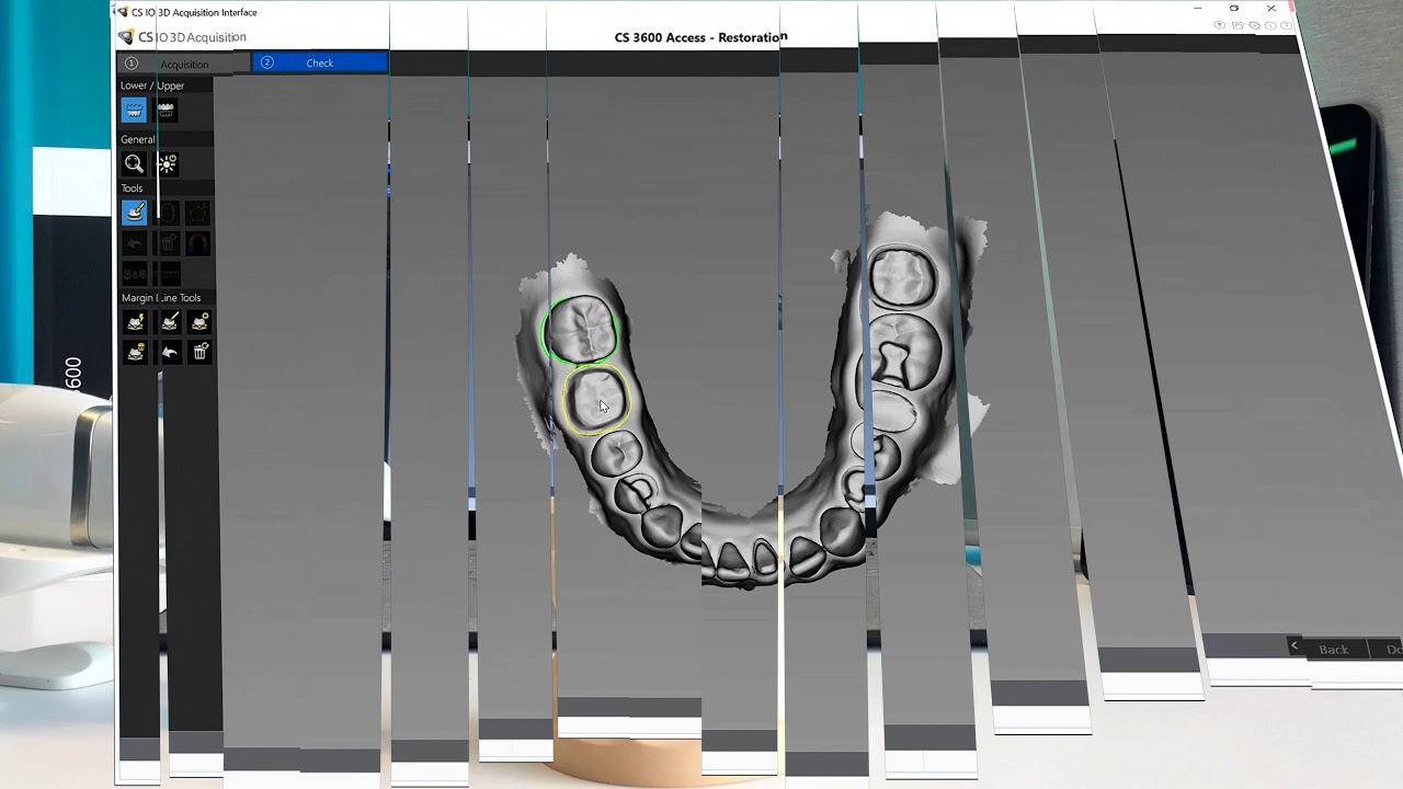 CS 3600 Access Intraoral Scanner | Streamhealth Dental